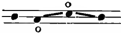 cambiata figure down-up-down